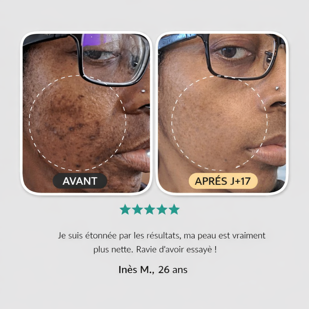 Crème anti-imperfections & anti-âge à base de collagène, niacinamide et vitamine C Lunara cosmetics