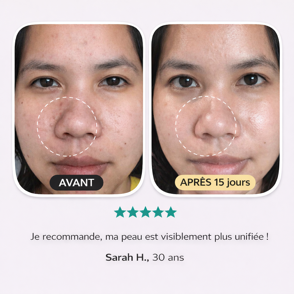 Crème anti-imperfections & anti-âge à base de collagène, niacinamide et vitamine C Lunara cosmetics