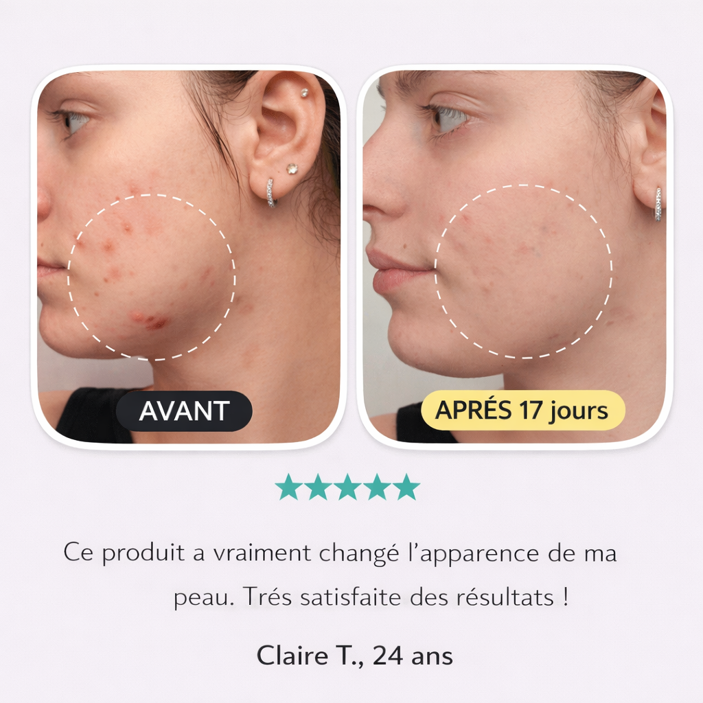 Crème anti-imperfections & anti-âge à base de collagène, niacinamide et vitamine C Lunara cosmetics
